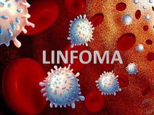 El linfoma es un tipo de cáncer