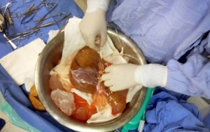 En el primer trimestre de 2016 se han efectuado 630 trasplantes.