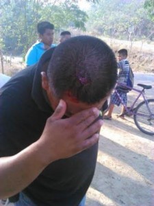 Con piedras y armas blancas se abalanzaron sobre las y los manifestantes.