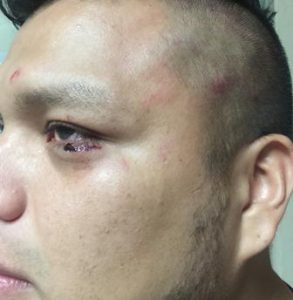 Miguel Ángel bajaba de un vehículo cuando sintió el primer cachazo en la cabeza propinado por Christian Reyes.