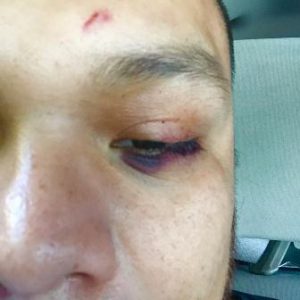 Le dio tantos cachazos hasta que se cansó su pistola.