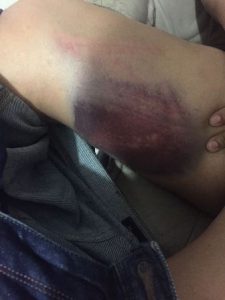 Enseguida sacó su tolete y le dio con él al joven hasta dejarlo medio muerto en la calle.