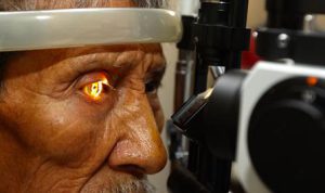 En un día se realizaron más de 100 cirugías de catarata.