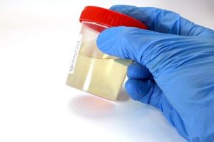 Podrían ser señales de enfermedad