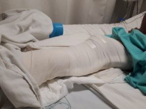 Sufrió heridos durante emboscada