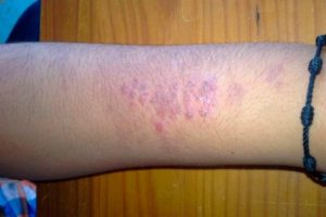 Realizan acciones para disminuir casos