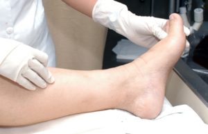 Técnicas quirúrgicas modernas permiten que el paciente camine casi de inmediato.