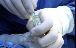 Trata IMSS a enfermos de Parkinson