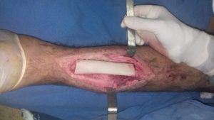 Luis René transitaba en su motocicleta cuando fue arrollado por un vehículo.