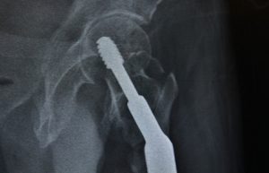 Seis de cada 10 adultos en México