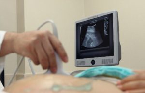 Hubo un aumento en el porcentaje de mujeres que tienen a sus bebés por parto vaginal y disminuyen las cesáreas.