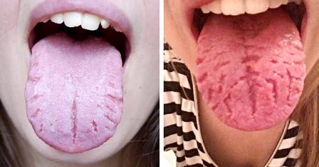Enfermedades se reflejan en la lengua