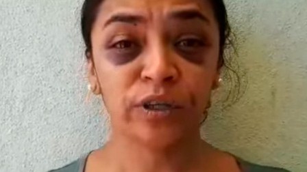 Condena CNDH agresiones de particulares y autoridades contra reportera Mitzi Yanet Torres Quintero