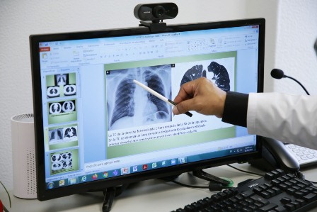 Atiende IMSS daño pulmonar y dificultad respiratoria causadas por Covid-19