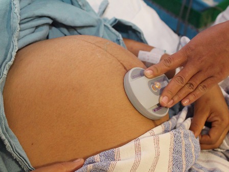 Ácido fólico, primordial para un embarazo saludable: SSO