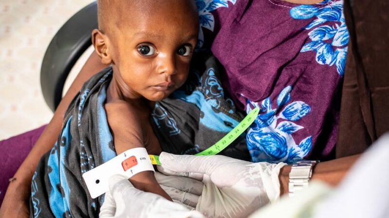 UN NUEVO NIÑO SUFRE MALNUTRICIÓN GRAVE CADA MINUTO EN 15 PAÍSES, ADVIERTE UNICEF