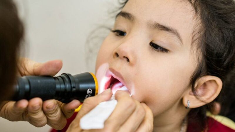 Casi la mitad de la población mundial descuida su salud bucodental