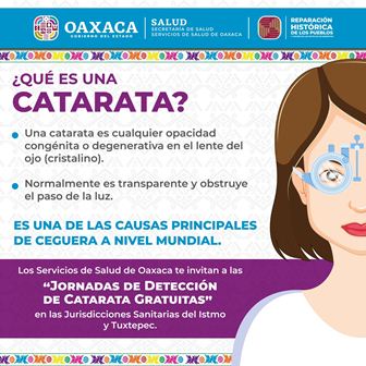 Realizarán Jornada de Detección de Catarata en las jurisdicciones sanitarias del Istmo y Tuxtepec