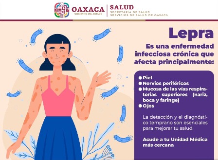 La lepra es prevenible y puede curarse con tratamiento: Servicios de Salud de Oaxaca