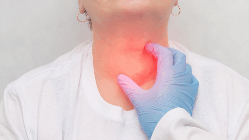 Cáncer de Cabeza y Cuello