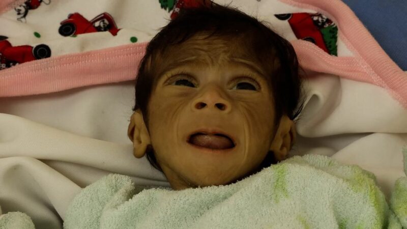 Alerta la Organización Mundial de la Salud de la ONU sobre una “hambruna masiva” en Gaza, provocada por el bloqueo de Israel