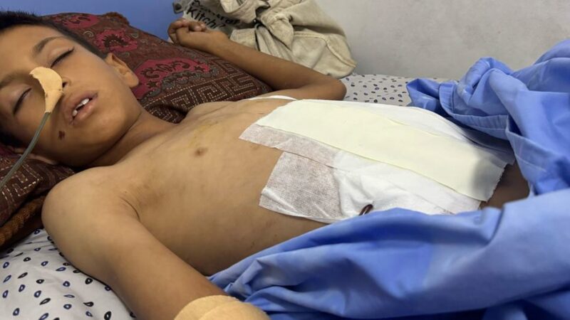 Los hospitales en Gaza están desbordados de heridos y las enfermedades raras empieza a surgir