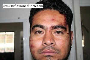 En riesgo seguridad del periodista, Jesús Olmedo, agredido el jueves 23; el gobierno de Gabino Cué indiferente