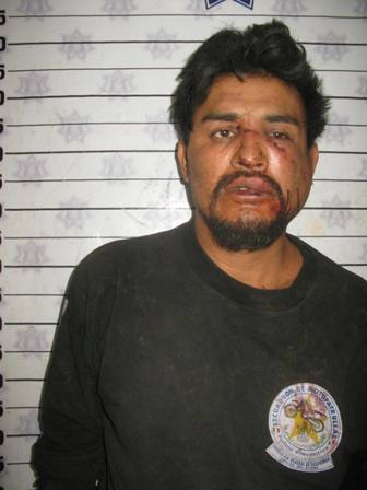 Macheteó a su camarada, le provocó heridas en la frente y brazo