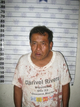 Detenido por el presunto delito de lesiones, hirió con un cuchillo a su rival