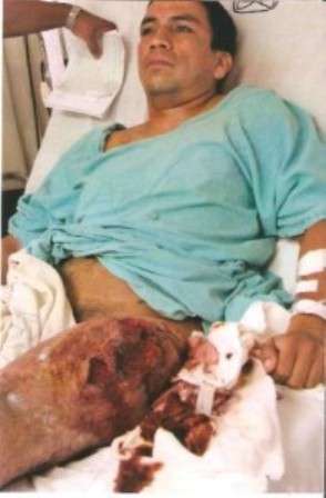 Consigna PGJE ante Juez, por intento de homicidio, a agresores del fotoperiodista Said Hernández