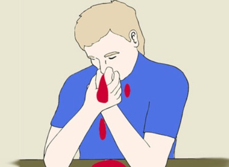 Garantiza IMSS atención de pacientes con hemofilia con tratamiento profiláctico y de base