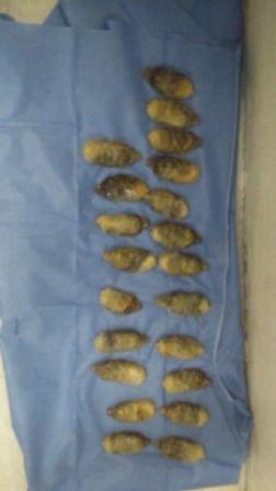 En el AICM, intercepta Policía Federal a ciudadano boliviano que ingirió envoltorios con droga