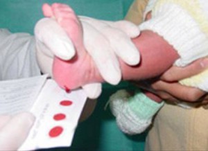Realiza IMSS tamiz neonatal a todos los recién nacidos para detectar problemas congénitos