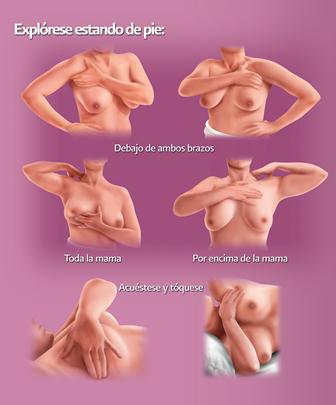 Autoexploración mamaria permite a las mujeres detectar cambios en las mamas o axilas
