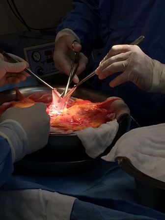 Recibe IMSS el primer corazón de 2017 con “Urgencia Nacional”