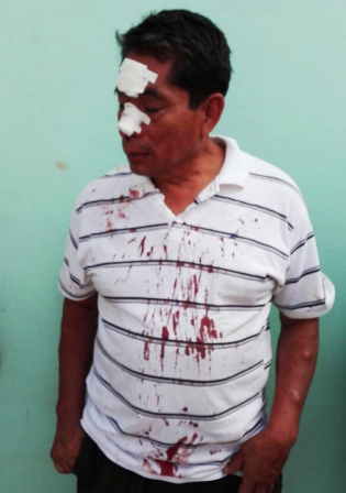 Golpea mototaxista de la “14 de Junio” salvajemente a presidente de la colonia Reforma Agraria
