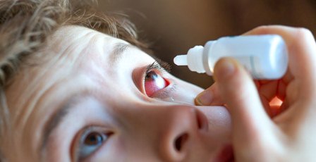 Cambios climáticos aumentan las reacciones alérgicas como la conjuntivitis