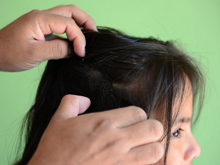 Pide Servicios de Salud de Oaxaca revisión constante para detectar brotes de piojos