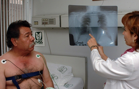 Enfermedad Pulmonar Obstructiva Crónica, sexta causa de muerte en el IMSS