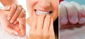 Manía peligrosa para la salud