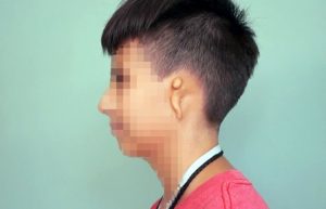 Separan los cinco dedos de la mano de un estudiante de secundaria.