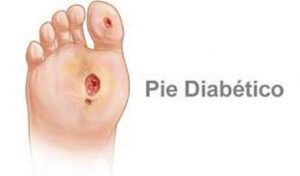 Lesiones no sentidas en pies