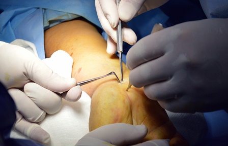 Recomienda IMSS proteger las manos para prevenir accidentes y daños irreversibles