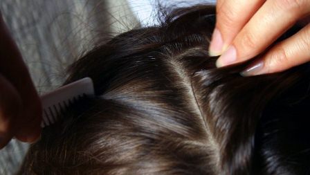 Recomienda IMSS visitar al médico en caso de pediculosis y evitar tratamientos caseros