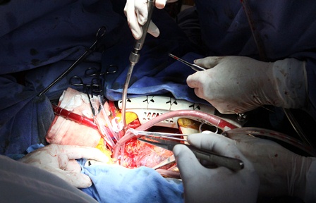 “Lalito” donó órganos a cinco niños para una segunda oportunidad de vida