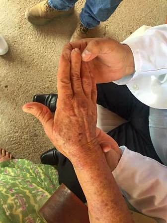 Realizan jornada de detección de lepra en Asunción Ixtaltepec, Oaxaca