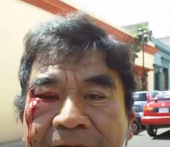 Denuncian agresión a reporteros cuando cubrían cierre de calles frente a la Secretaría de Salud del gobierno de Oaxaca, por empleados de funerarias que exigen operar crematorios sin cubrir reglamento sanitario.