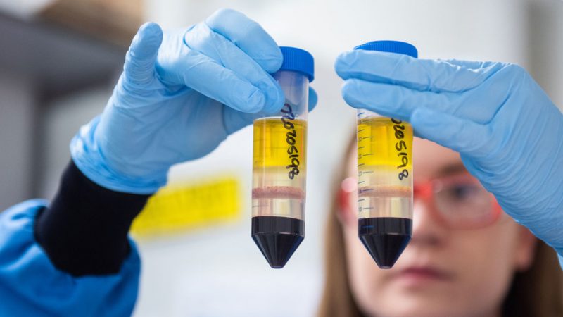 EL PERIODO ENTRE LAS DOS DOSIS DE LA VACUNA CONTRA EL COVID-19 SOLO DEBE EXTENDERSE EXCEPCIONALMENTE, DICE LA OMS