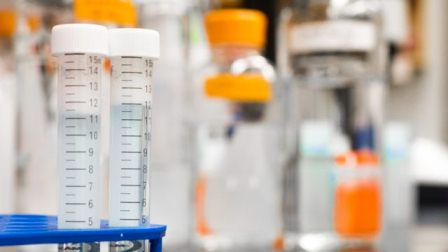 Lanza Roche Diagnostics prueba rápida para detectar Covid-19 en México