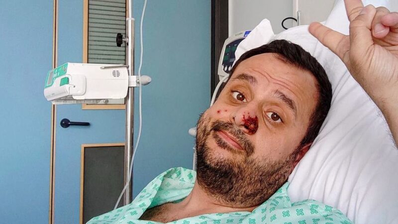 Vacunación masiva contra viruela del mono no es necesaria: OMS